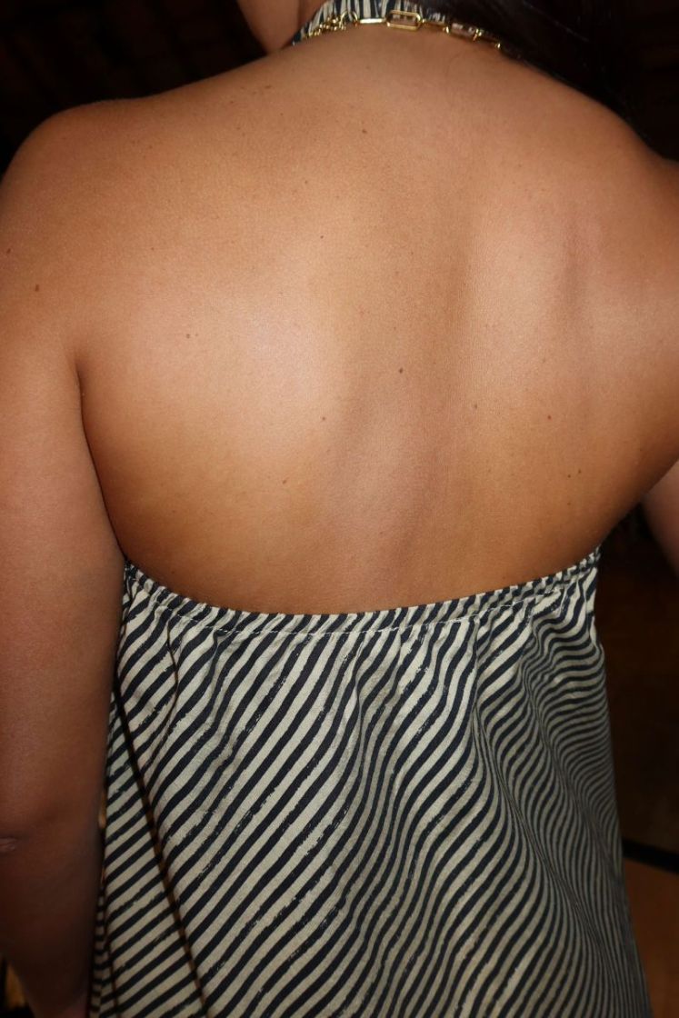 Top Rosa Default